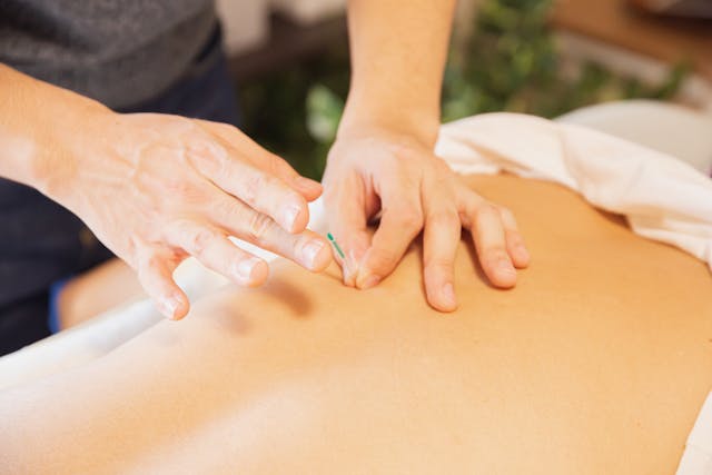 Person in an acupuncture session